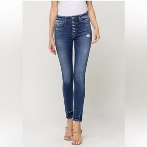 High Rise Buttonfly Skinny Jean